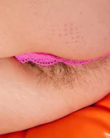 We Are Hairy - 15-0016015